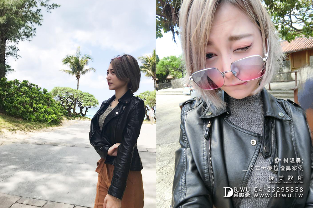 【隆鼻推薦】三段式隆鼻台中首選,隆鼻手術之神吳峻豪醫師|峻美診所
