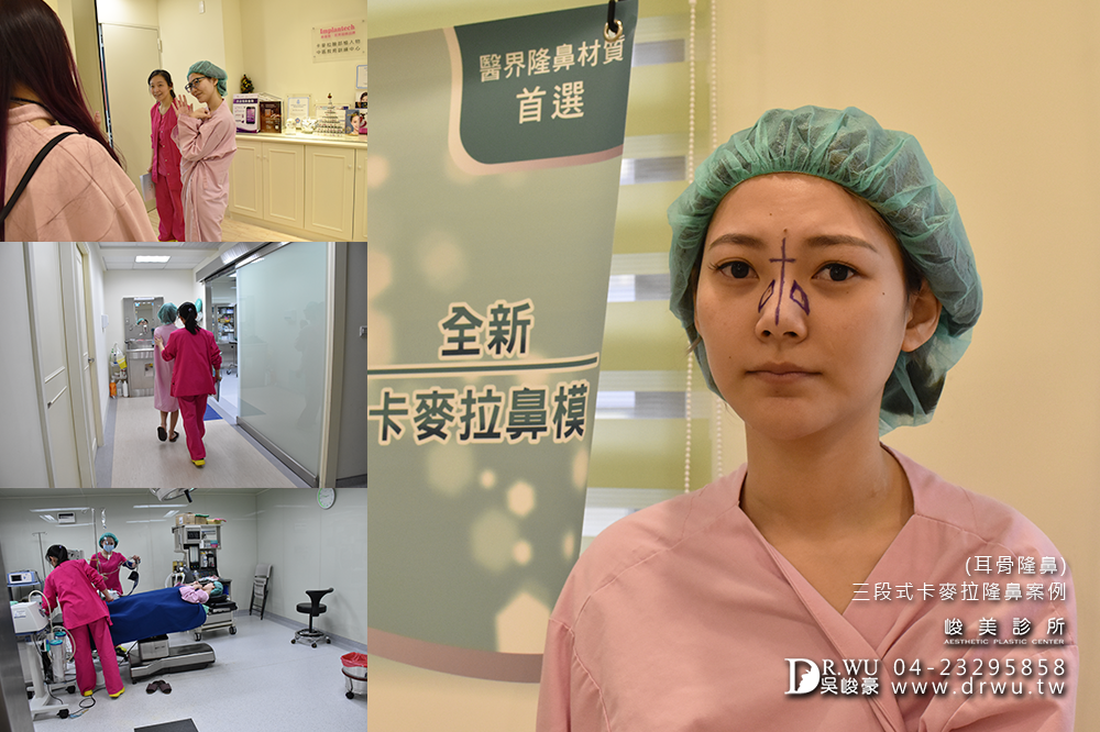 【隆鼻推薦】三段式隆鼻台中首選,隆鼻手術之神吳峻豪醫師|峻美診所