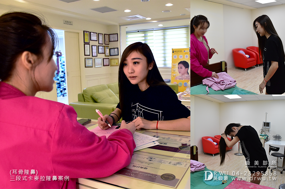 【卡麥拉三段式隆鼻=卡麥拉鼻模+耳軟骨+鼻中隔延長】高挺美鼻的誕生,調整鼻頭角度是大重點!|峻美診所