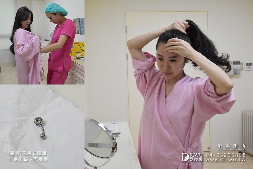 【重置隆鼻】隆鼻重做交給峻美,二次隆鼻後更完美!|三段式卡麥拉隆鼻手術+卡麥拉下巴|峻美診所