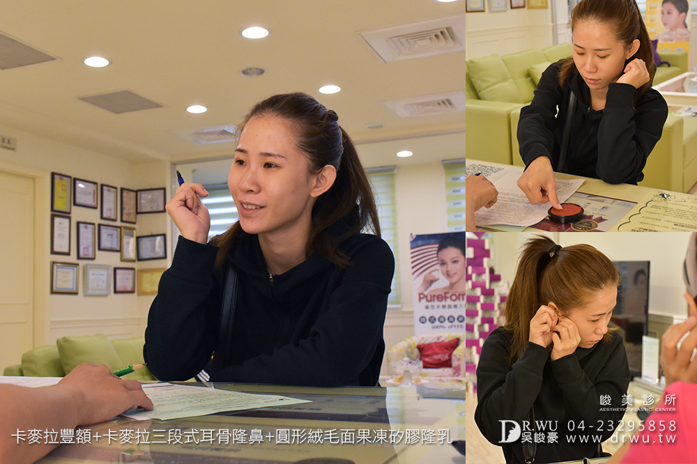 【額鼻胸】整形出屬於個人化風格的美|卡麥拉豐額+卡麥拉隆鼻+果凍矽膠隆乳手術|峻美診所