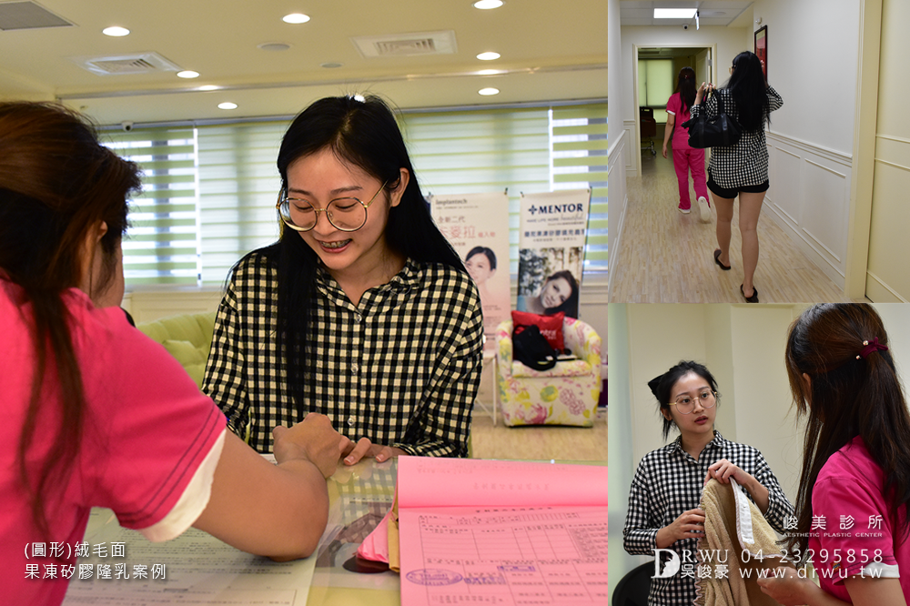 【隆乳案例】加厚型調整型內衣通通丟掉,美美的胸型免按摩~|台中隆乳手術|峻美診所