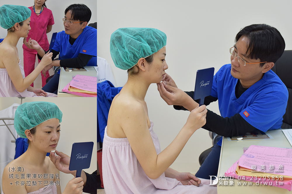 【Mentor曼陀隆乳】如同水滴形狀般的美胸,免按摩保養超便利!|水滴內視鏡果凍矽膠隆乳手術|