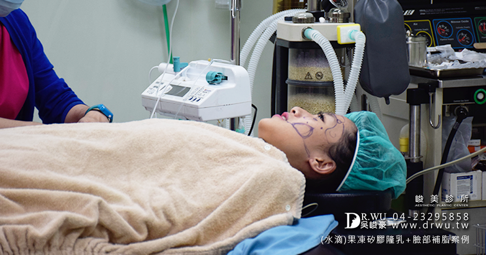 【隆乳】隆乳經驗+自體脂肪補臉分享=超級滿意|女神見證|峻美診所